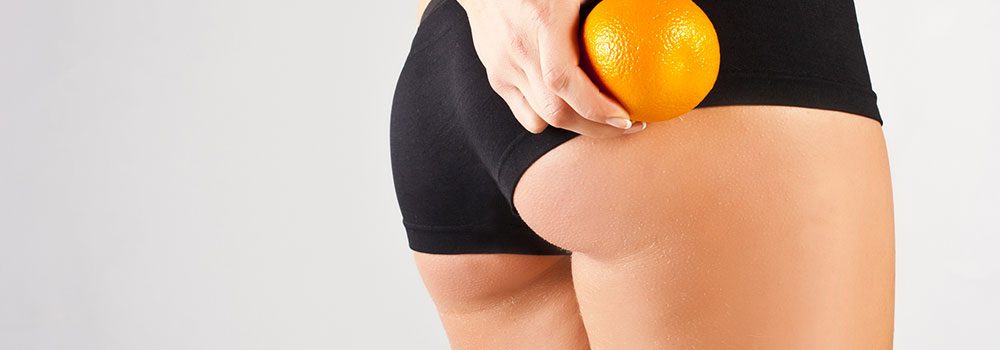 CELLULITE